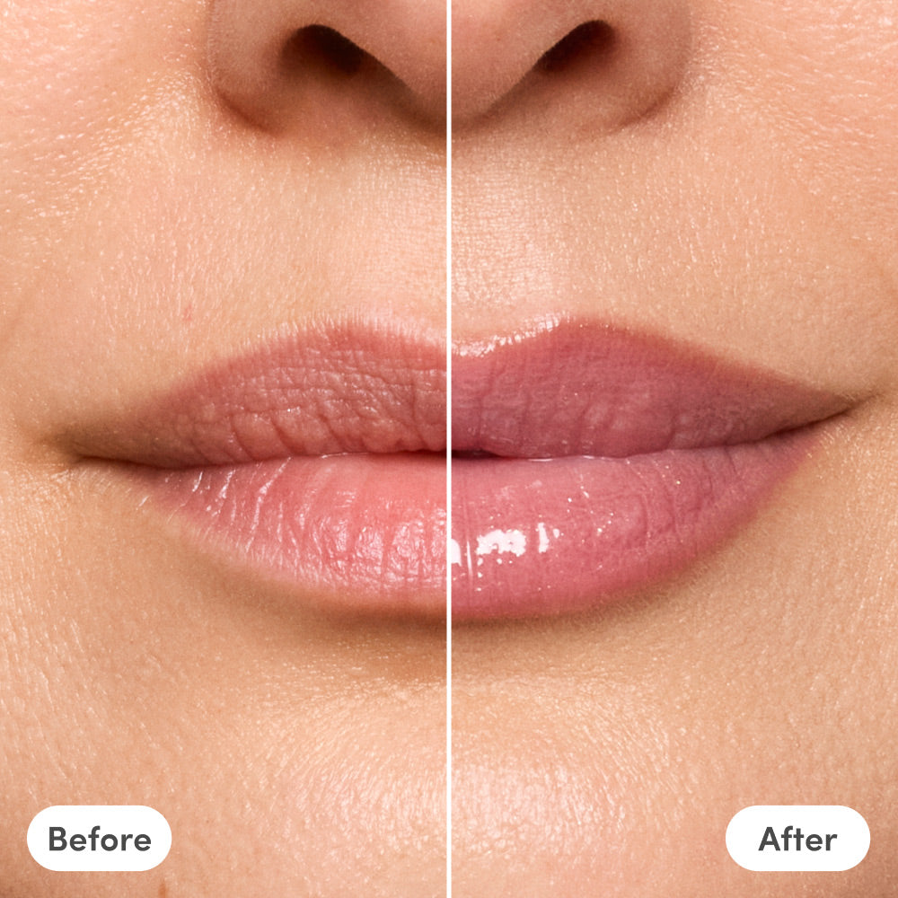 The Lip Reset Kit