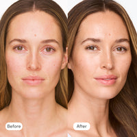 BFF SPF 30 Cream - Medium