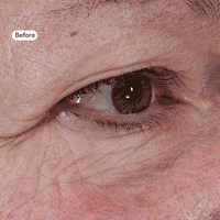 Take Back Time Eye Treatment