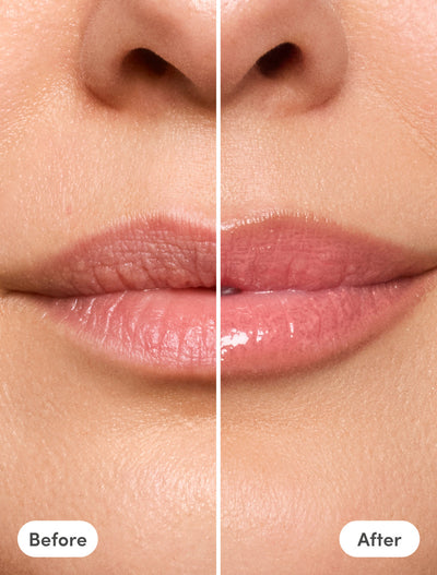 The Lip Reset Kit - Fran + Thea