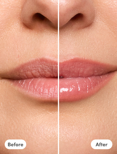 The Lip Reset Kit - Gloria + Ally