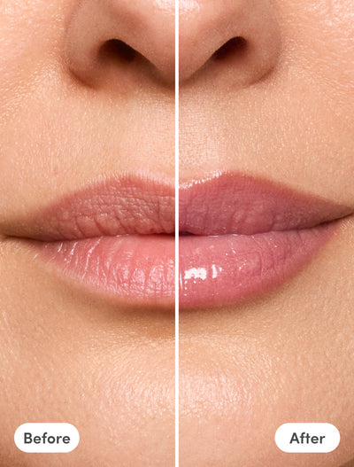The Lip Reset Kit - Megan + Matilde